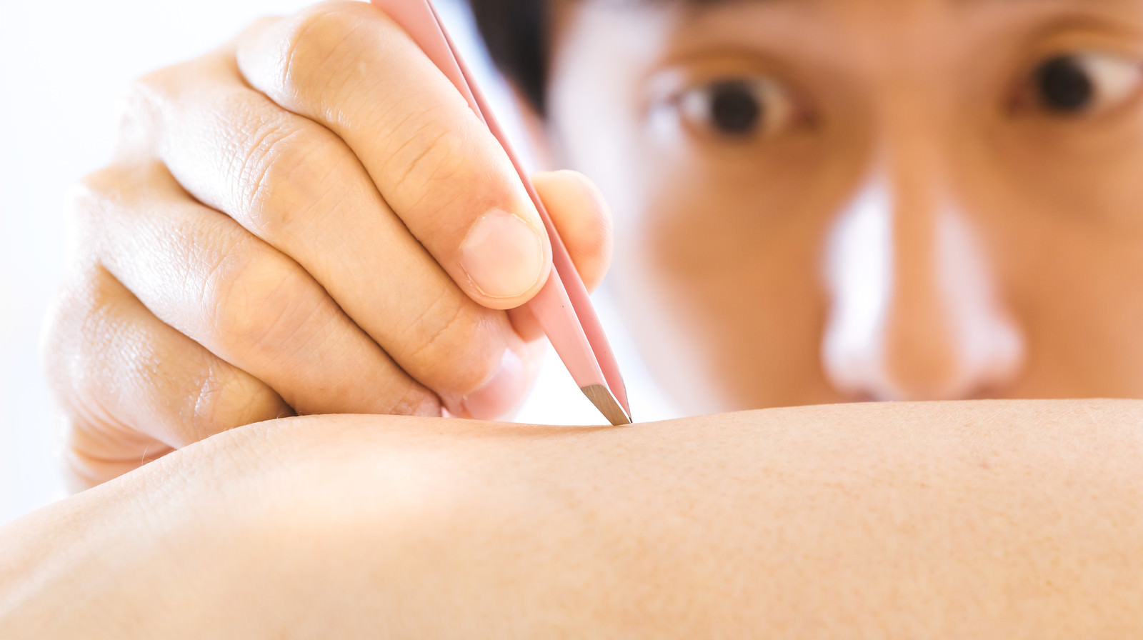 自己処理で毛抜きをしてくるの写真素材 ぱくたそ