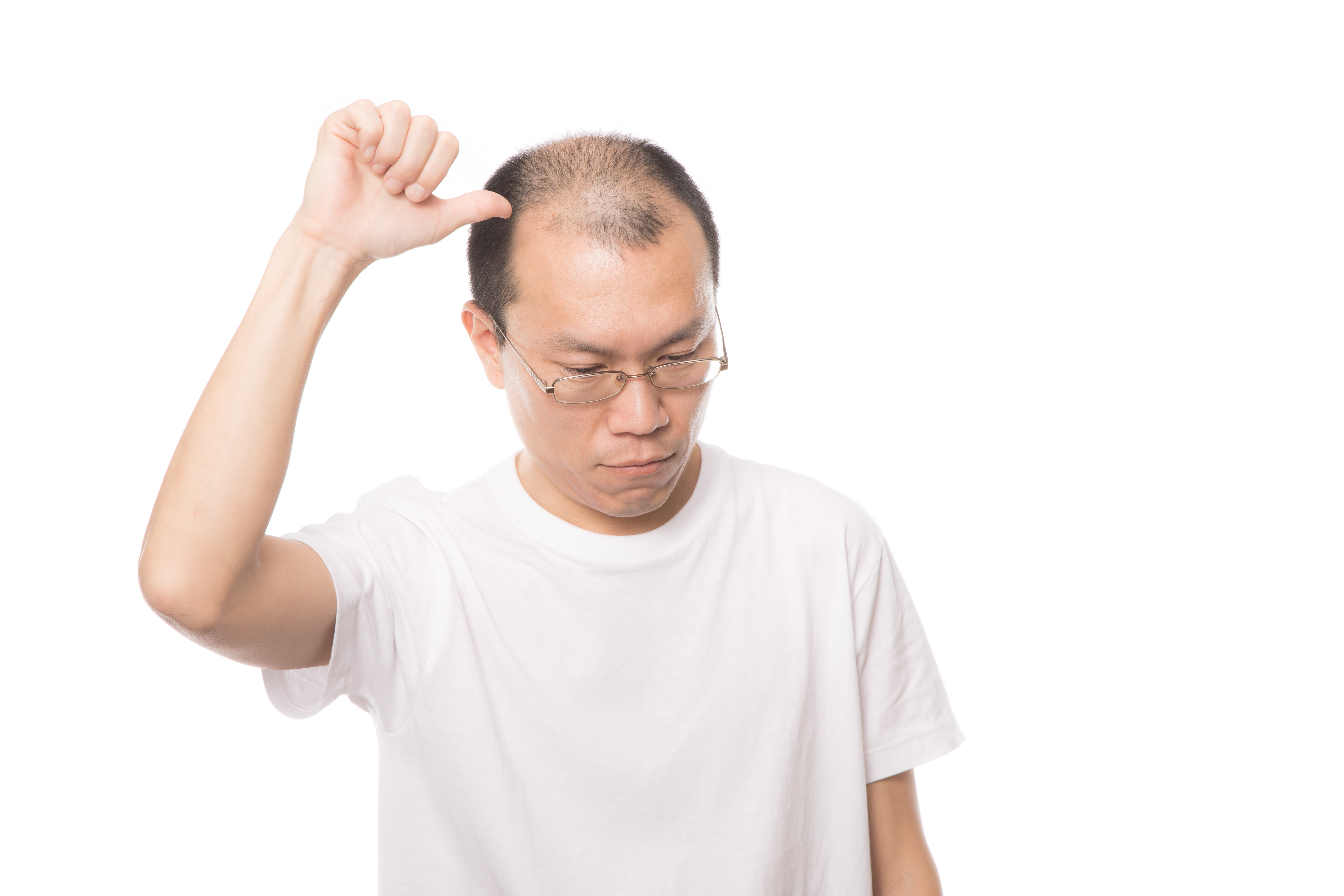 俺の生え際を超えていけの写真素材 ぱくたそ