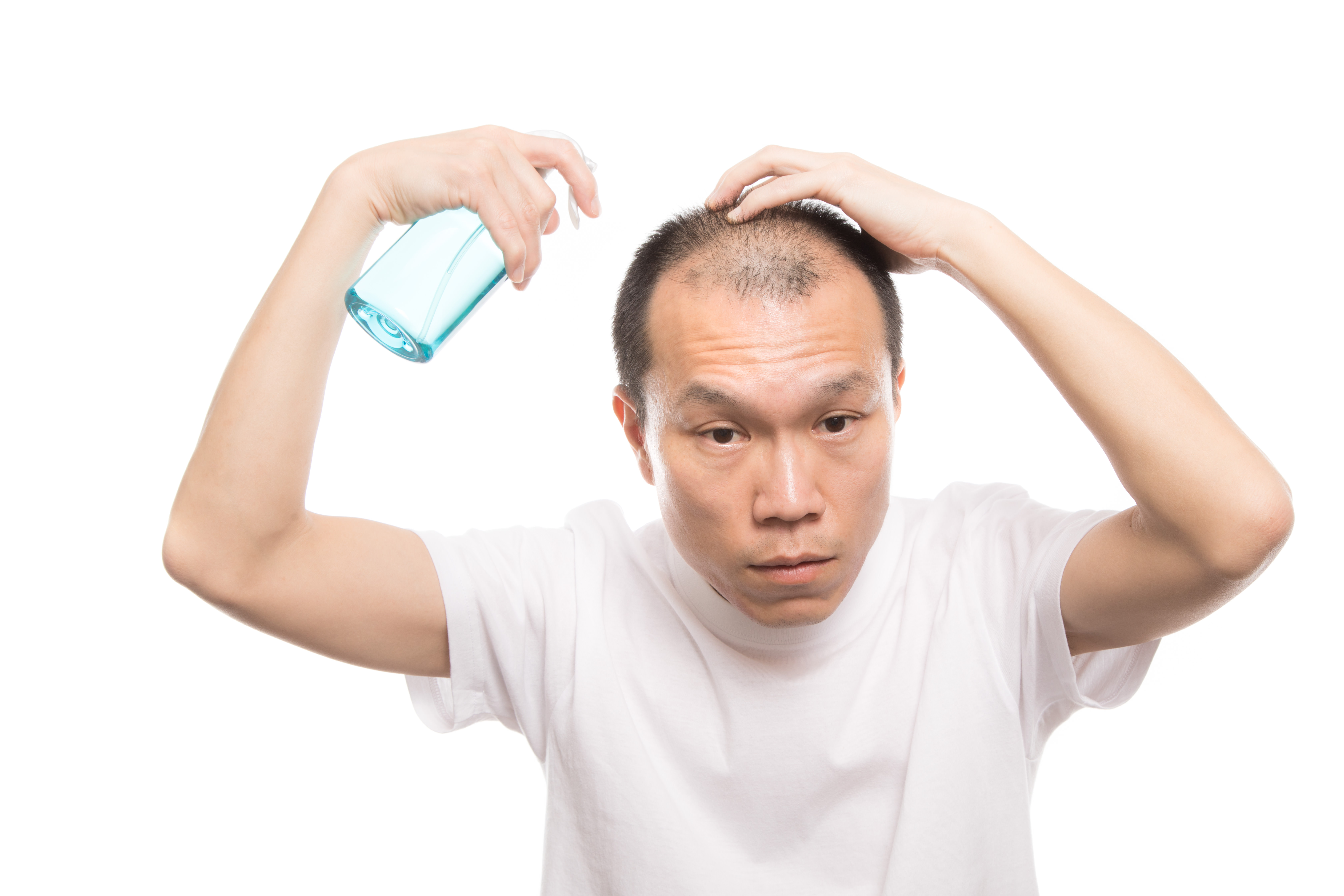 トニックスプレーを頭皮に噴射する薄毛男性の写真素材 ぱくたそ